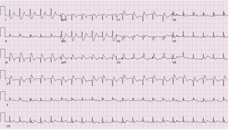 Figure 1