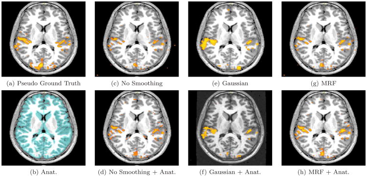 Fig. 11