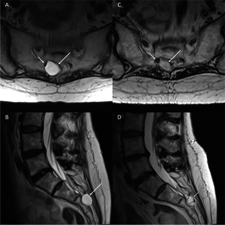 Fig. 11