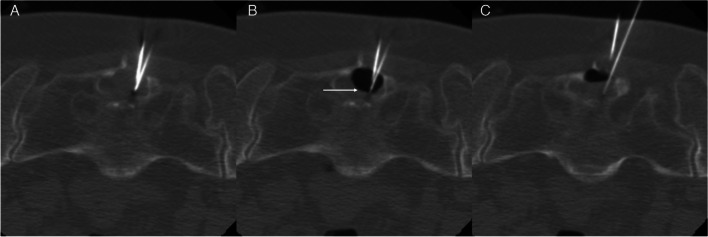 Fig. 10