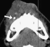 Figure 18