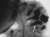 Figure 15
