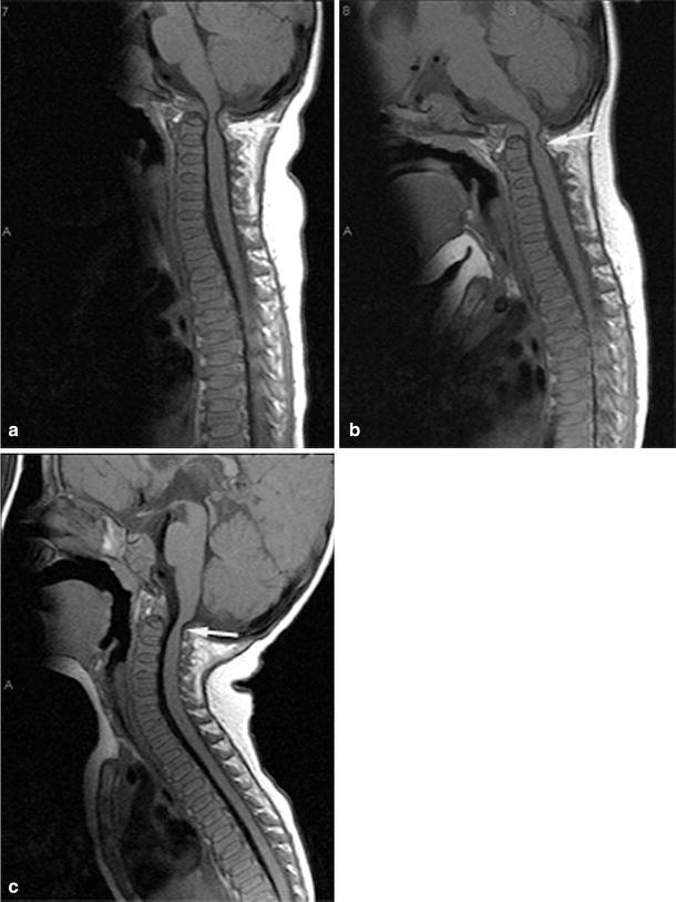 Fig. 5