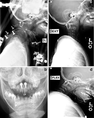 Fig. 4