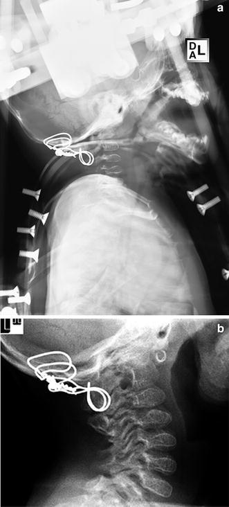 Fig. 6