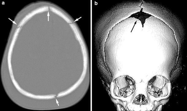 Fig. 1