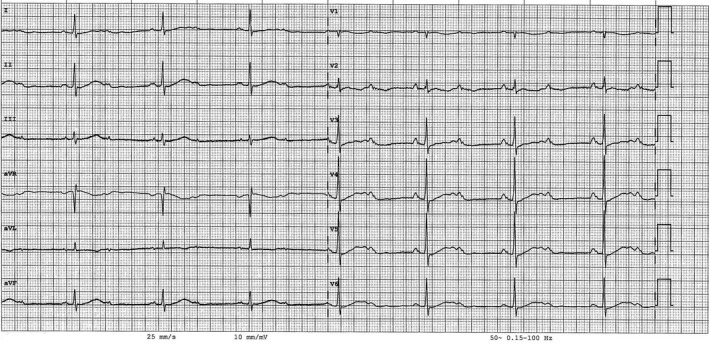 FIGURE 1