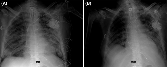 FIGURE 4