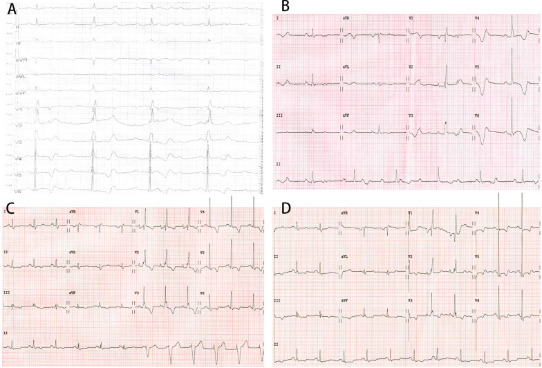 Fig. 2