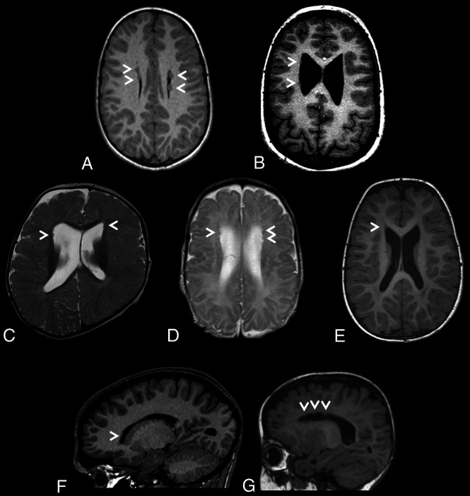 FIG 1.