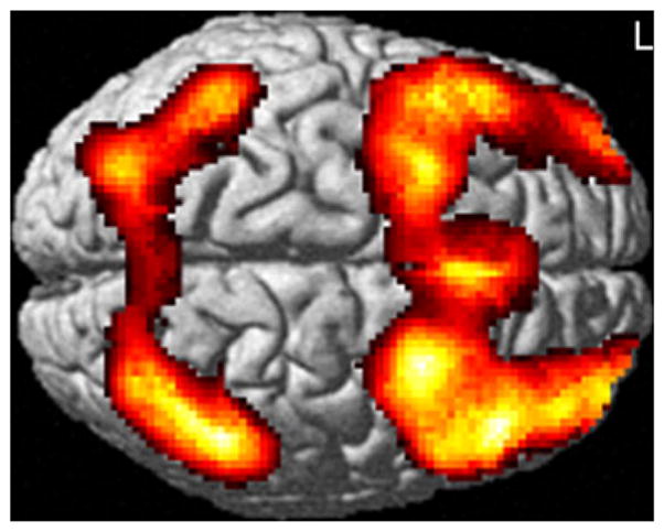 Functional MRI of mild traumatic brain injury (mTBI): progress and ...