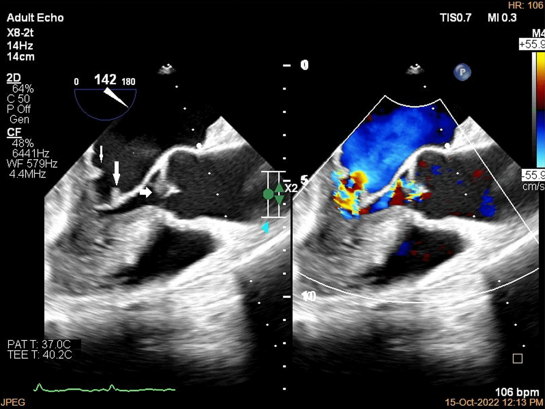 Fig. 4