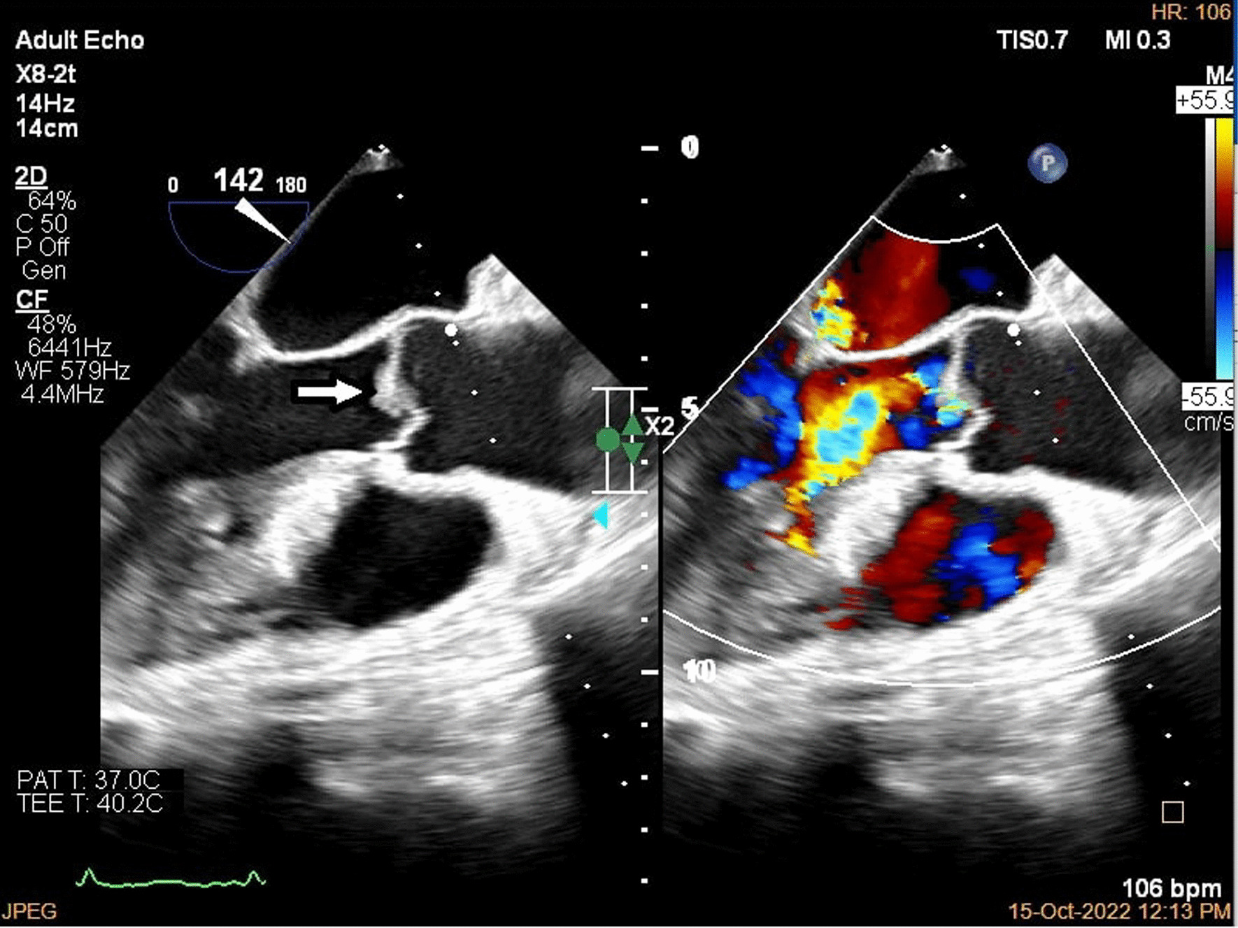 Fig. 5.