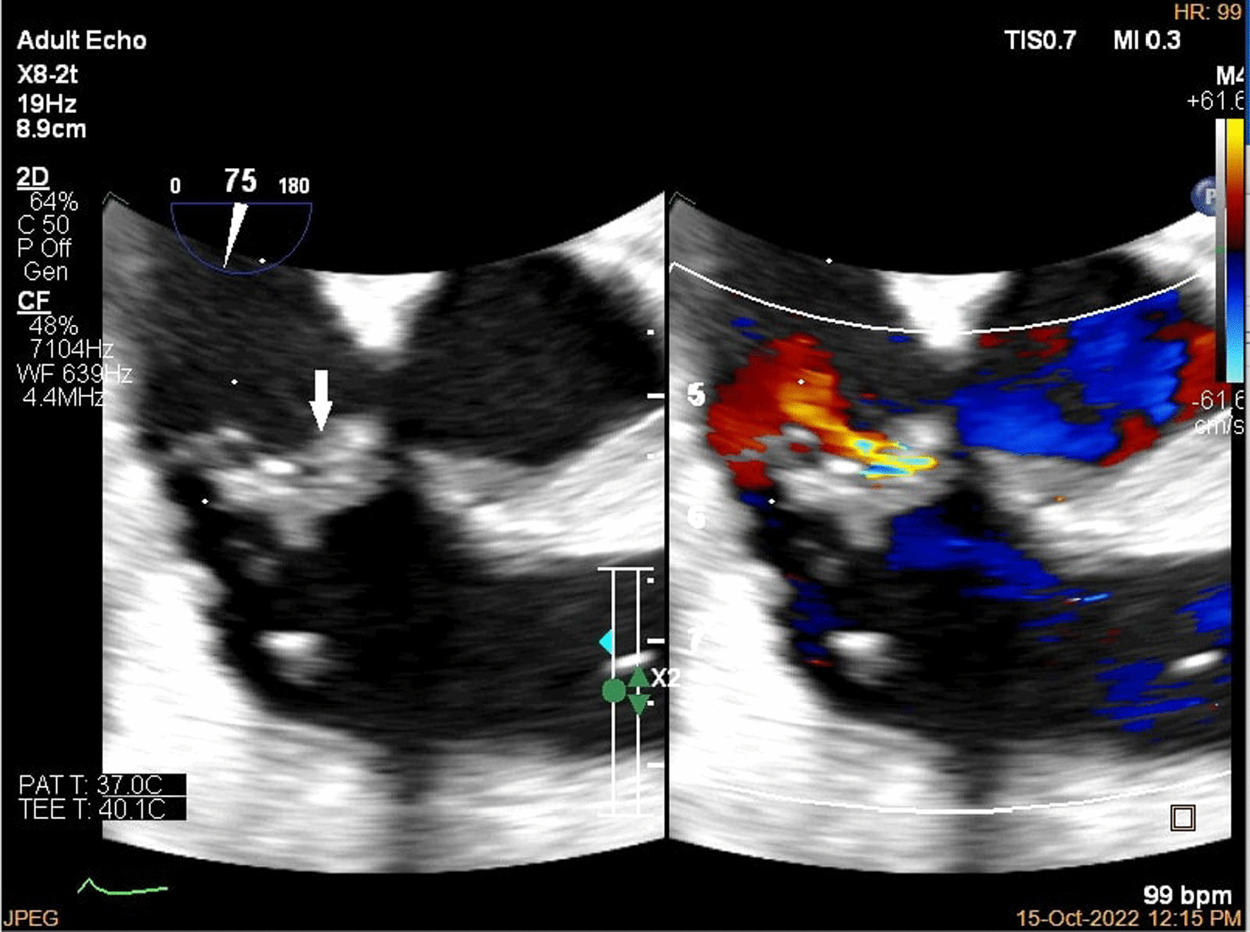 Fig. 6.