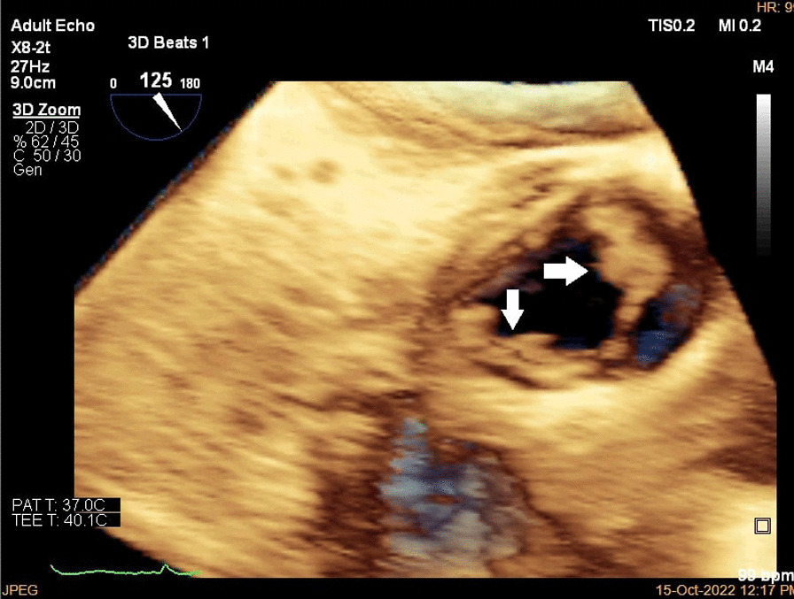 Fig. 3.