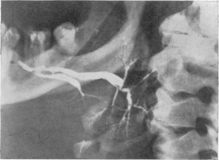 Fig. 11