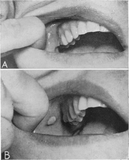 Fig. 15