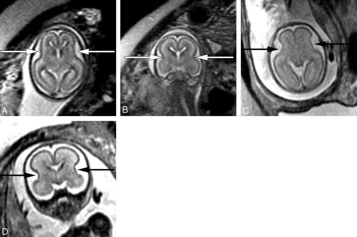 Fig 3.