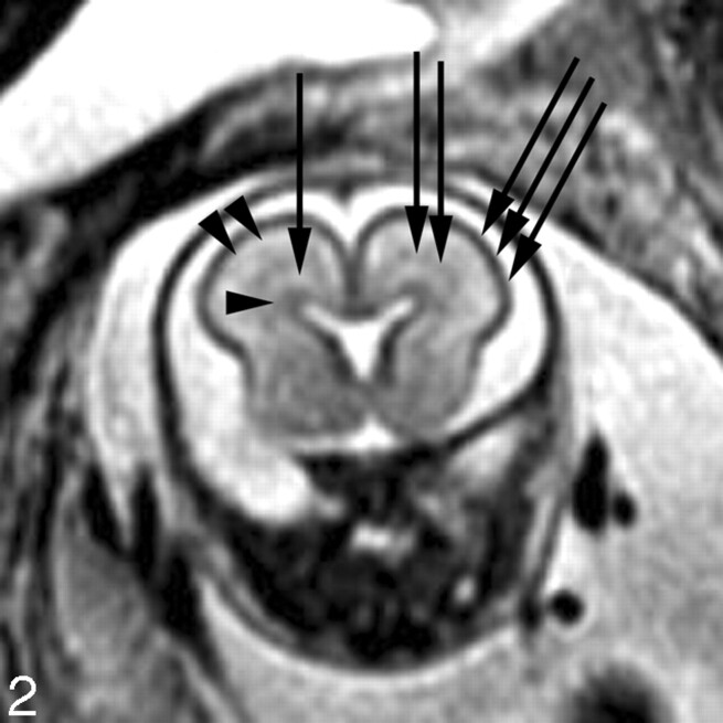 Fig 2.