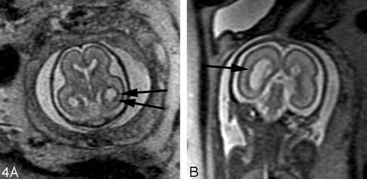 Fig 4.