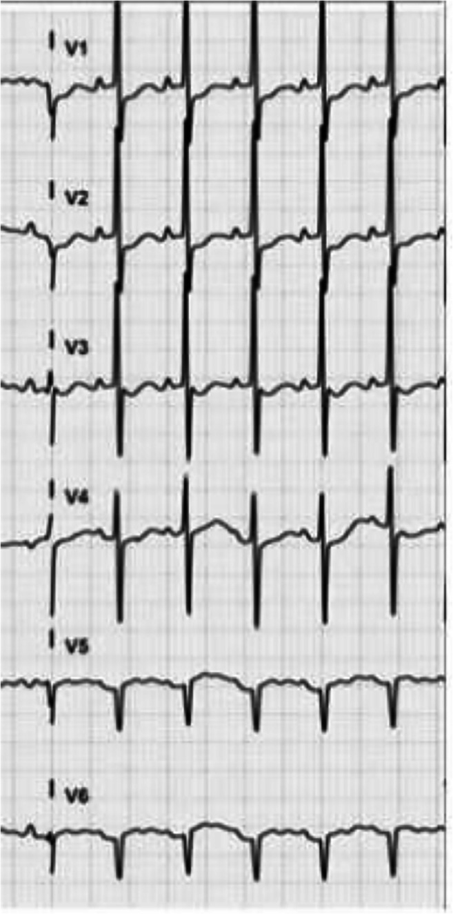 Fig. 1