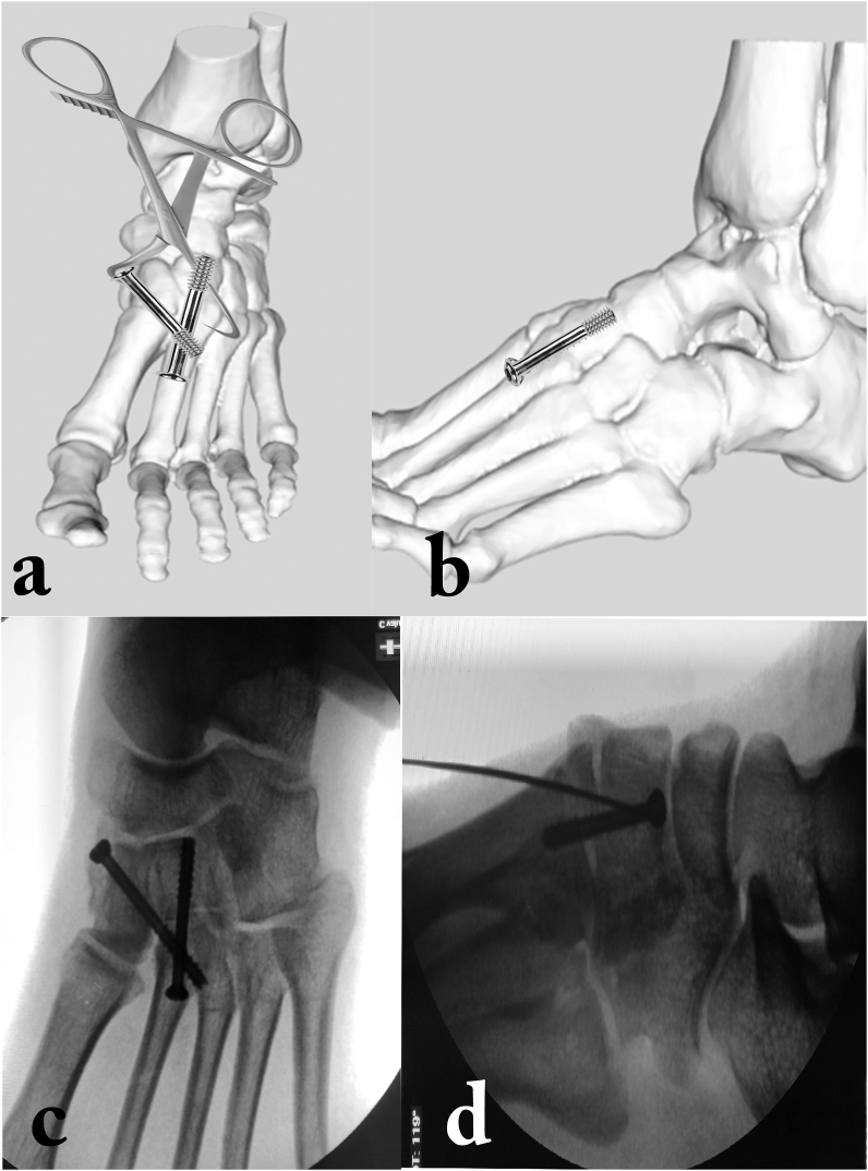 Fig. 4