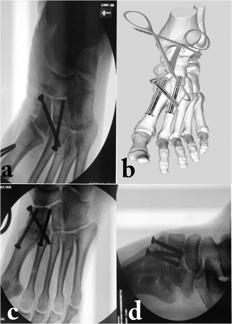 Fig. 5