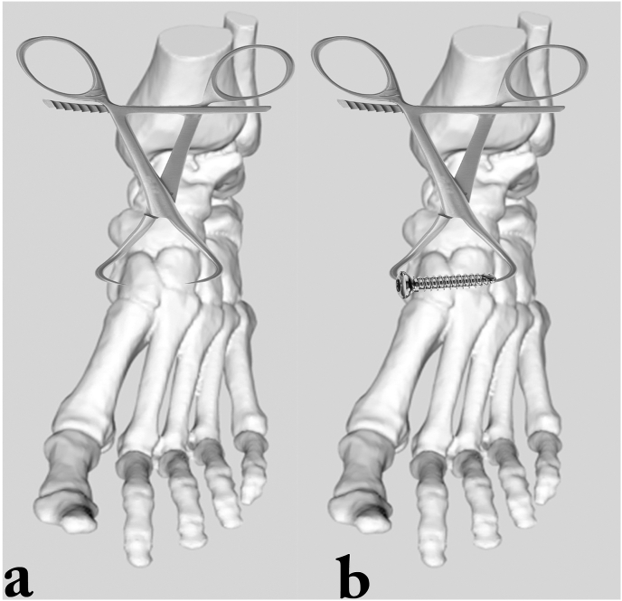 Fig. 2