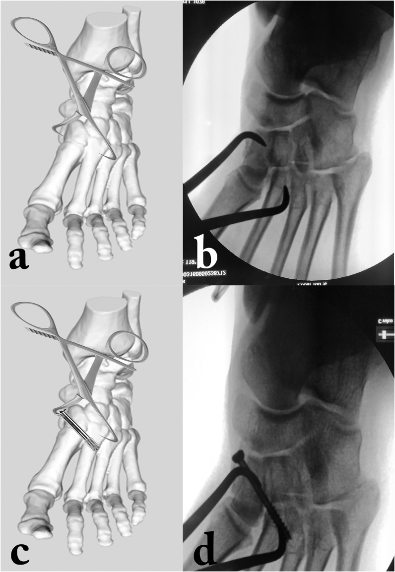 Fig. 3