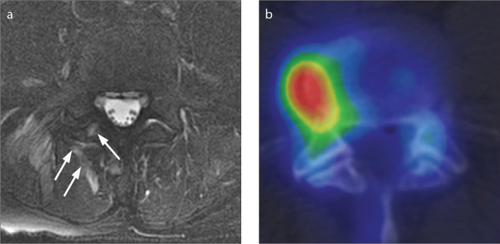 Figure 2. a, b