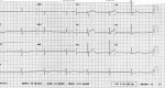 Figure 1: