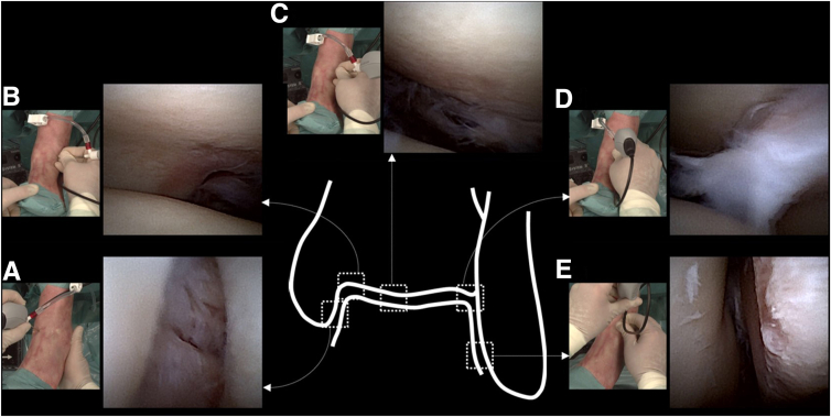 Fig 4