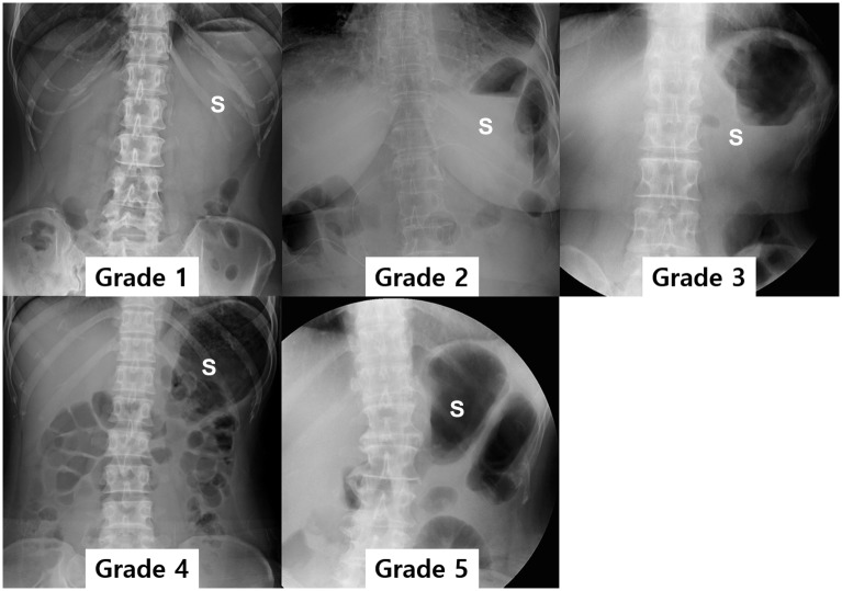 Fig 5