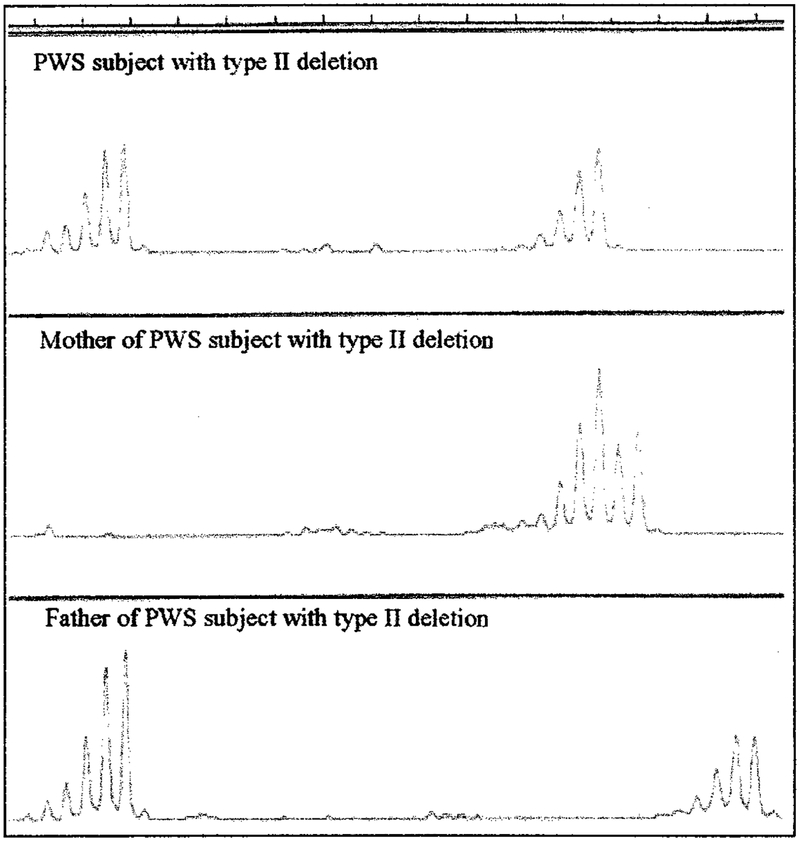 Fig 2.