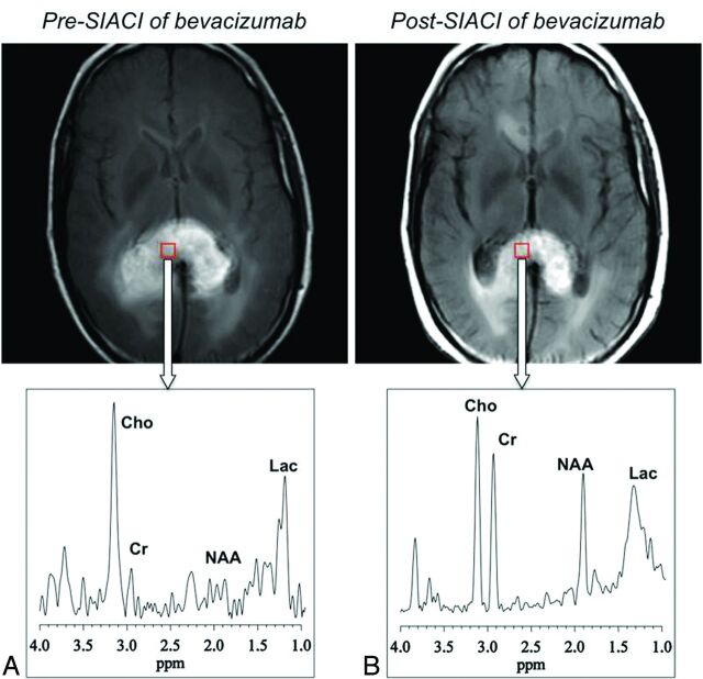 Fig 3.