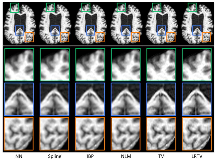 Fig. 11