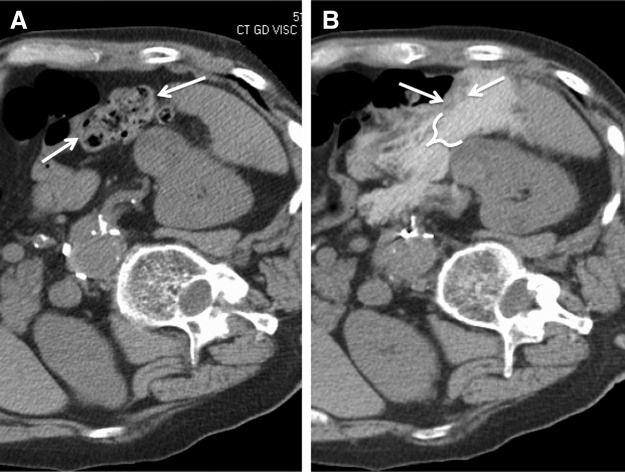 FIG. 4.