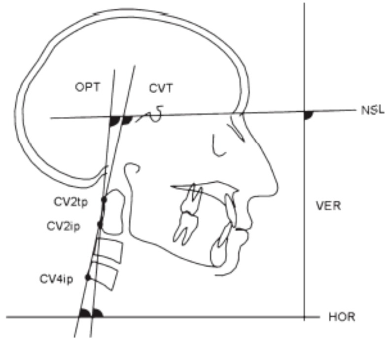 Fig. (2)