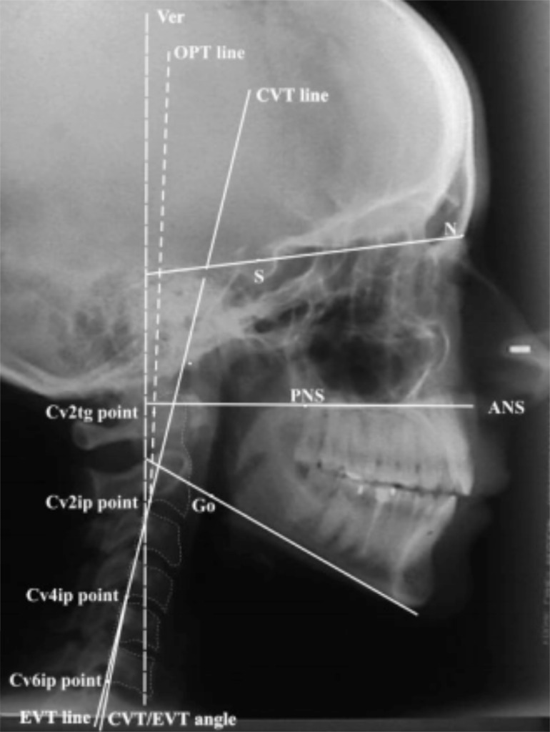 Fig. (1)