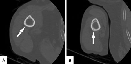 Fig. 4A–B