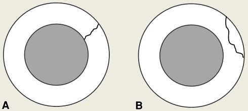 Fig. 6A–B