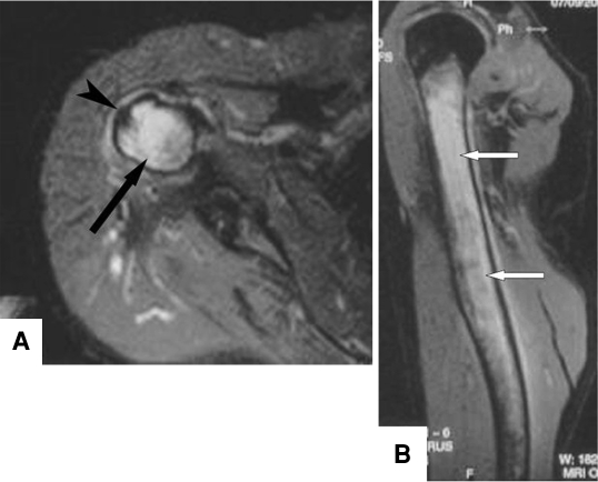 Fig. 2A–B