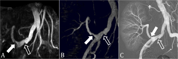 Figure 12