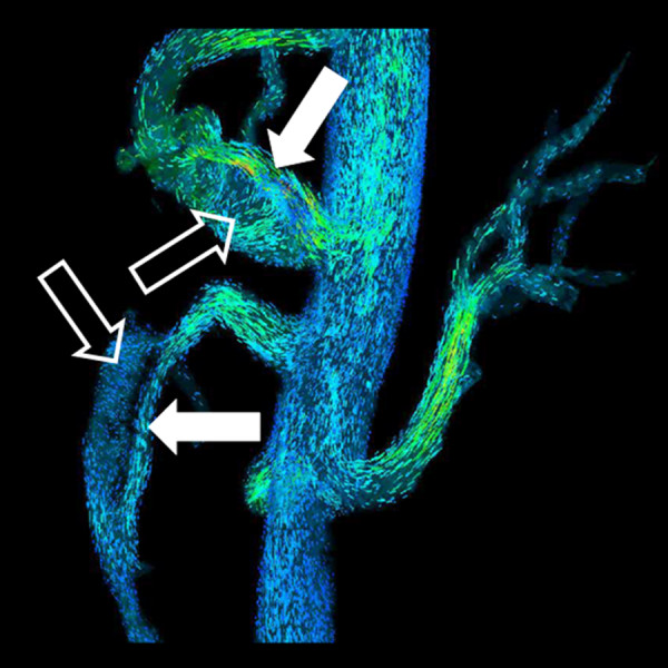 Figure 14