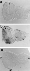FIG. 6