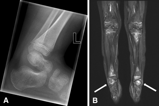 Fig. 3A–B