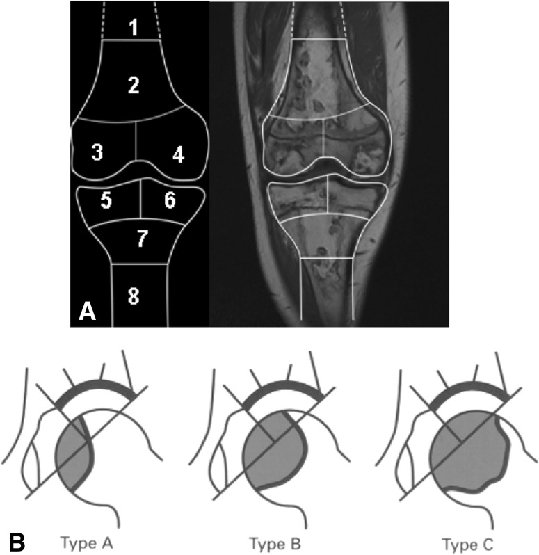 Fig. 1A–B