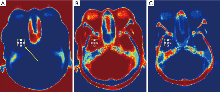 Figure 2