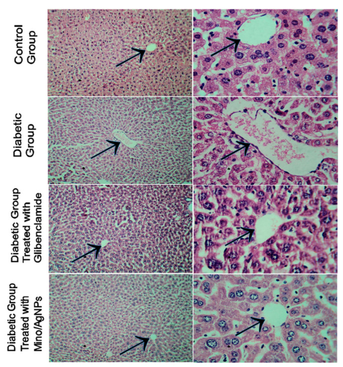 Figure 13