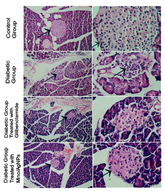 Figure 11